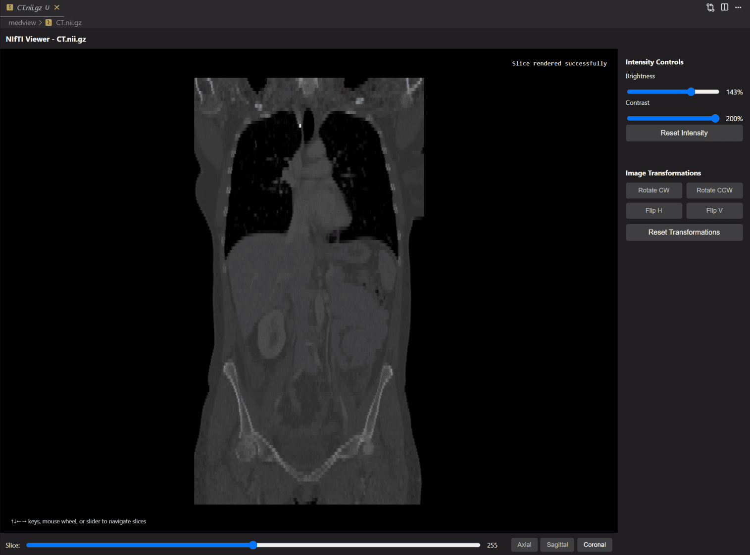 MedView