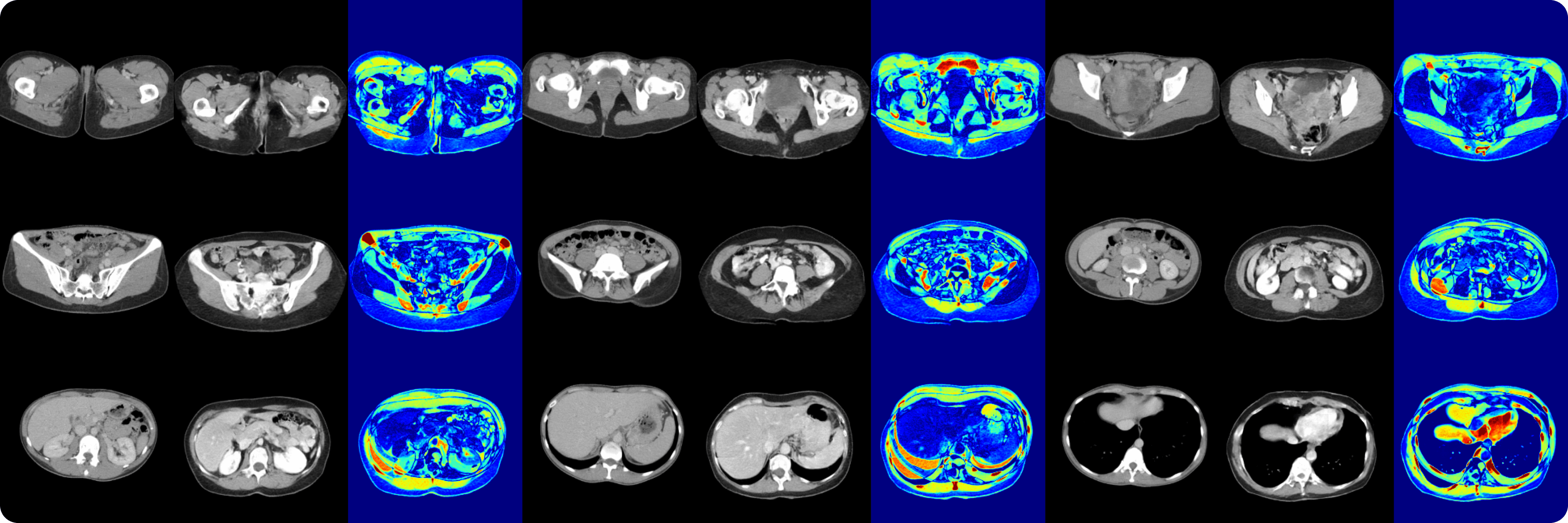 Real vs. synthetic CT